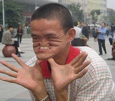 Ugly people