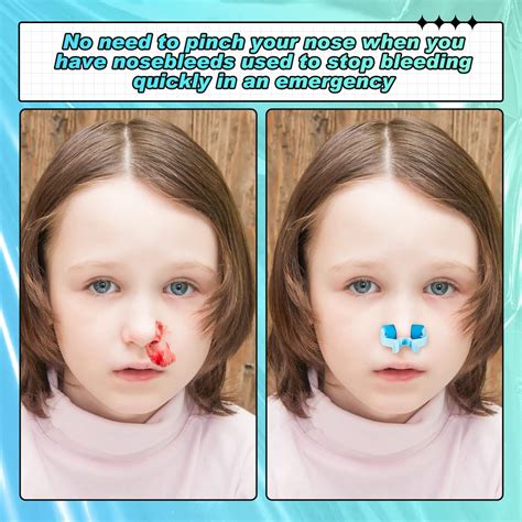 Snapklik.com : Fabbay 100 Pcs Stop Nosebleeds Clip Nose Bleed Stopper