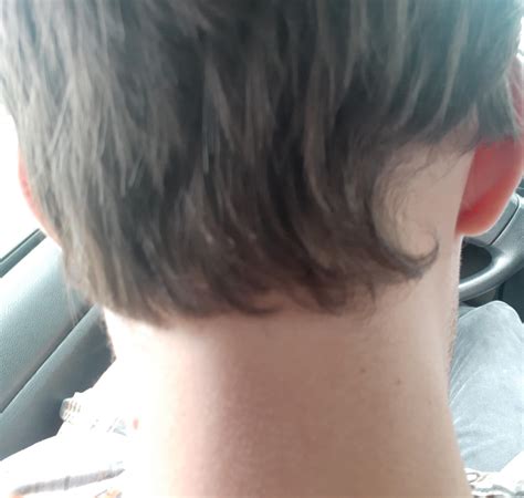 Cowlick Back Of Neck