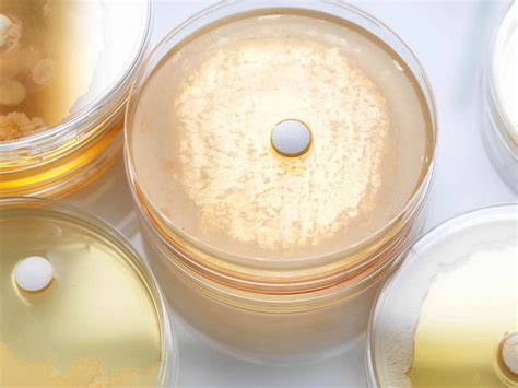 Übersicht über die Ergebnisse von Blutkultur-Labortests - MedDe