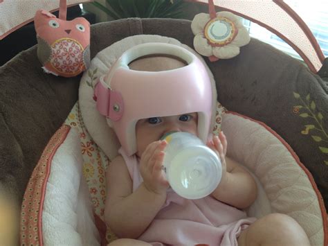 Baby Helmets Work: Emersyn's Results - Mom's Me Time