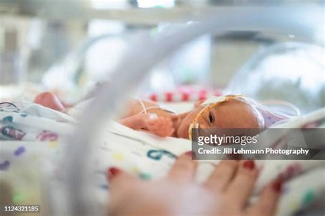 440 Twins Incubator Stock Photos, High-Res Pictures, and Images - Getty ...