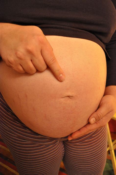 Why Do I Pick My Belly Button at Christopher Bryant blog