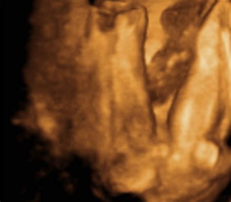 3D-ultrasound, 22 weeks pregnant - DocCheck