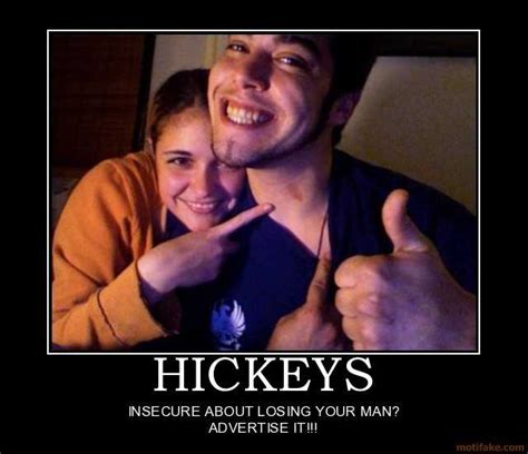 hickey  love bite   questions answered hickey solution