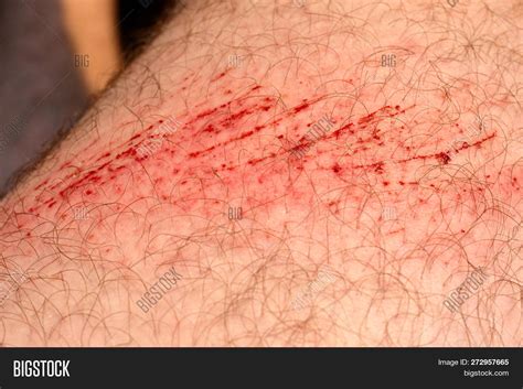 Skin Scratch