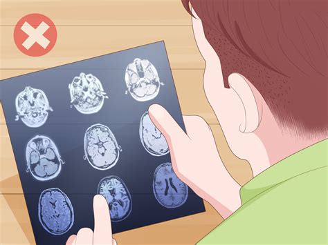 How to Read an MRI: 15 Steps (with Pictures) - wikiHow