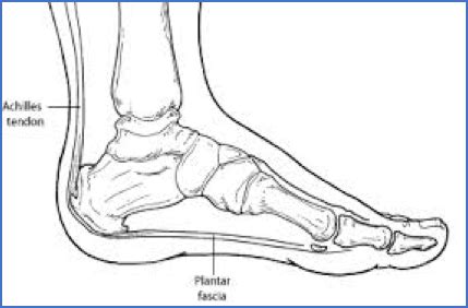 Why Does My Heel Hurt? Common Causes Explained