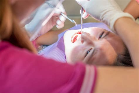 How Long Does a Dental Cleaning Take? – Beezzly