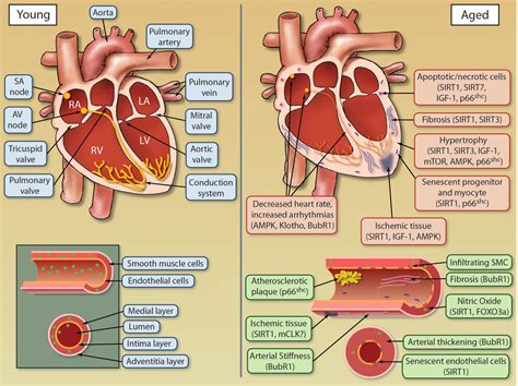 The Intersection Between Aging and Cardiovascular Disease | Circulation ...