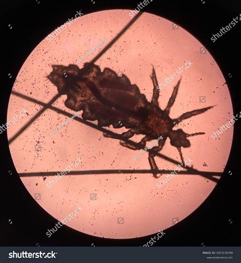 Cat Lice Microscope at Jarred Moen blog