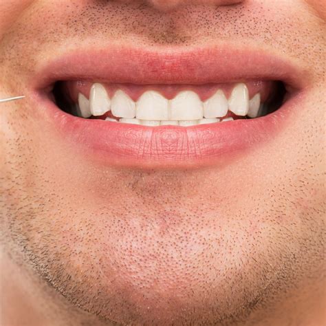 teeth cleaning  dental  implant centre