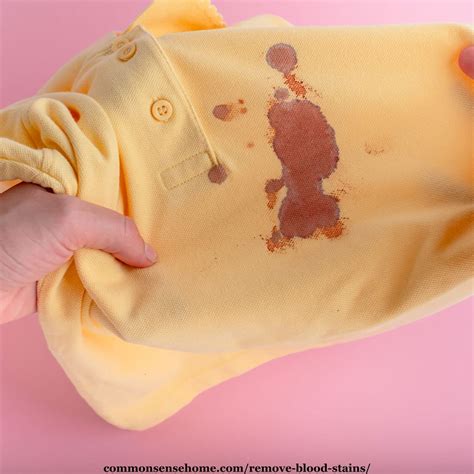 The Secret Stain Solver: 5 Proven Methods To Erase Old Blood Blemishes At Home