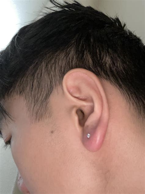 Infected Ear Piercing Causes And Treatments Ear Infected Pierced Ear