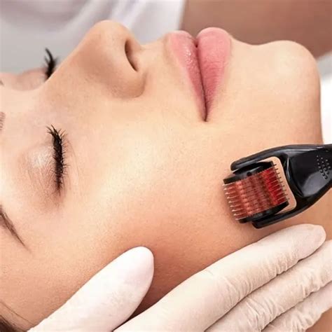 Para Que Serve O Microagulhamento - Microagulhamento - Dra. Bárbara Figueiredo - Dermatologista