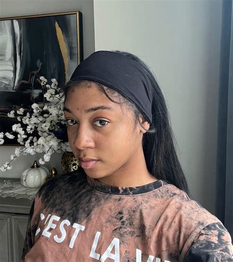 𝐍𝐀𝐎𝐌𝐈 𝐑𝐎𝐒𝐄 | Living with Lupus has been a journey to say the least. #AD
