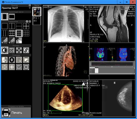 Vidar Dicom Viewer - просмотр медицинских изображений