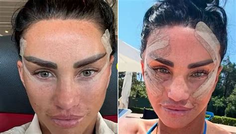 katie price unveils bandaged face   recovers  surgery