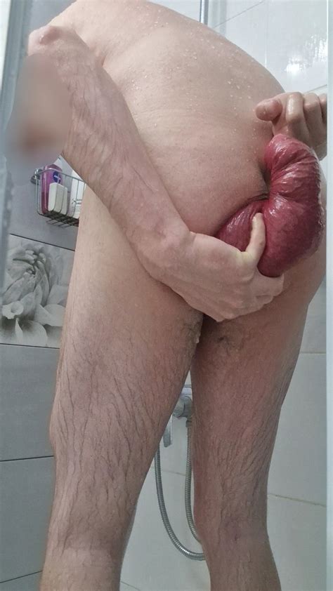 gays biggest anal prolapse thisvidcom