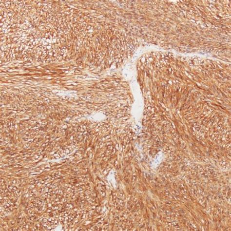 cd antibody reagent  immunohistochemistryprimary antibodies
