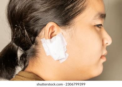 close  ear bandage caused  ear stock photo  shutterstock