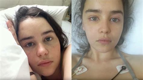 Do You Know? Emilia Clarke Underwent Health Struggles While Filming GOT ...