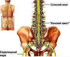 ПОЗВОНОЧНИК – СИНДРОМ КОНСКОГО ХВОСТА