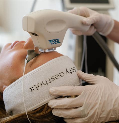 bbl photofacial defy aesthetic