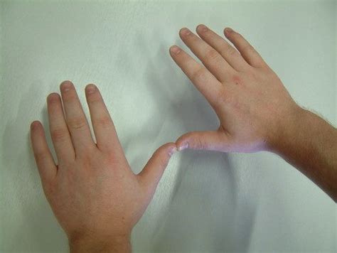 Wrist Range of Motion Exercises | The Hand and Wrist Institute | Dallas, TX