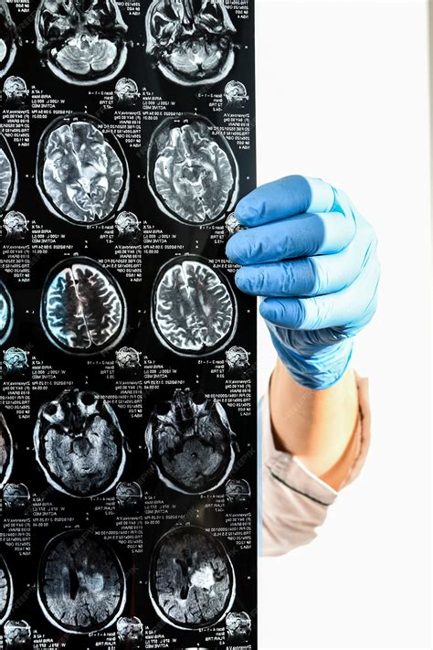 Premium Photo | Doctor in protecting gloves holding brain MRI in