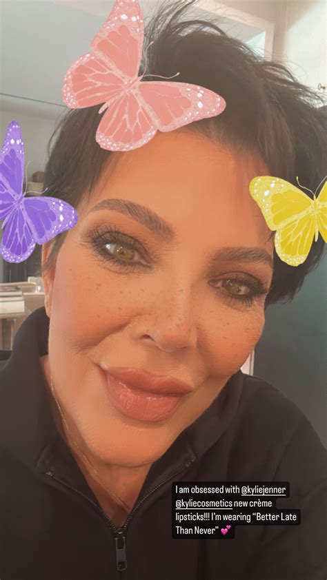 kris jenner new face 2