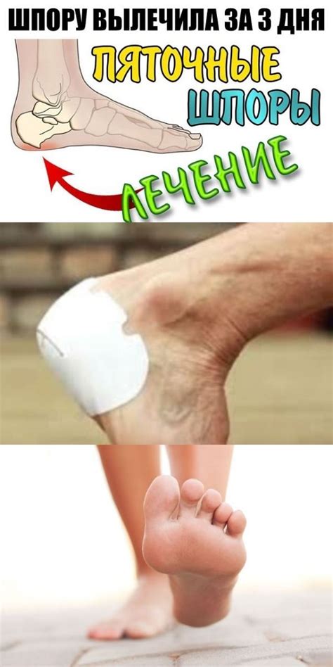 Полезные советы | Health facts, Health department, Natural therapy