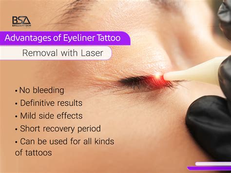 Eyeliner Tattoo Removal | Advantages, Side Effects + FAQ