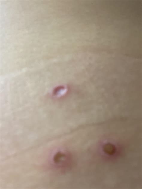 So anyone know what the hell this is ・ popular.pics ・ Viewer for Reddit