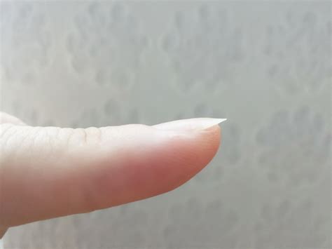 指の爪が反る – 爪が反り返る 原因 – NRDTX