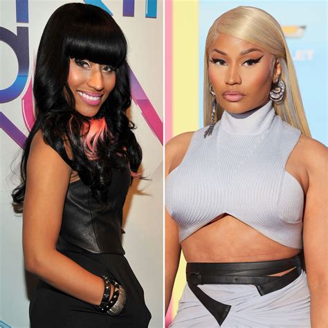 Did Nicki Minaj Get Plastic Surgery? Transformation Photos | Life & Style