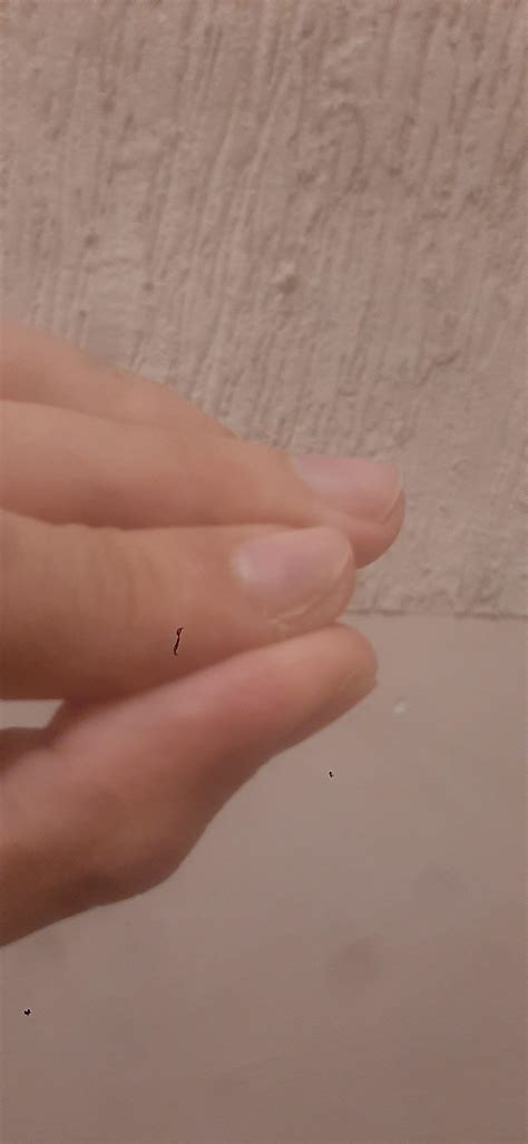 Does anyone know why my index fingernail grows to the sides? Is it