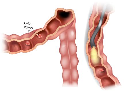Bay Area Endoscopy Center