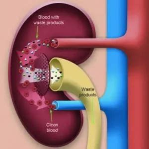 How Does Dialysis Work? - Mobil Dialysis