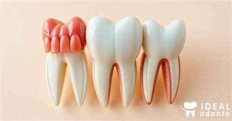 5 Tipos de Dentes e Suas Funções - Planos Odontológicos - Blog Ideal Odonto