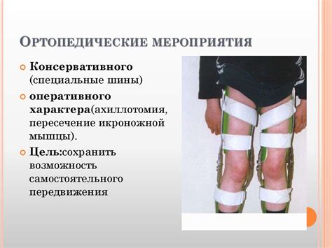 Прогрессирующая мышечная дистрофия Дюшена и Беккера - презентация онлайн