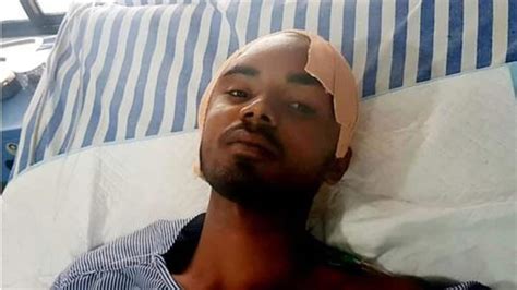 Iron rod passed through this man's skull, he miraculously survived