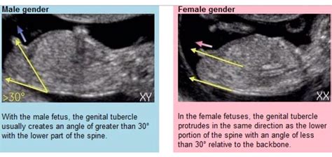 pregnant women archives fetalcalc