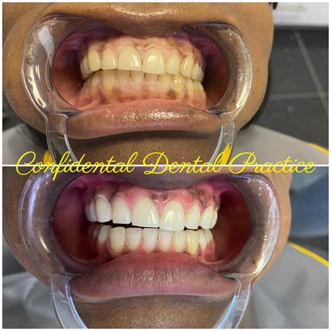 ConfiDental Dental Practice (@confidental_dental_practice) • Instagram