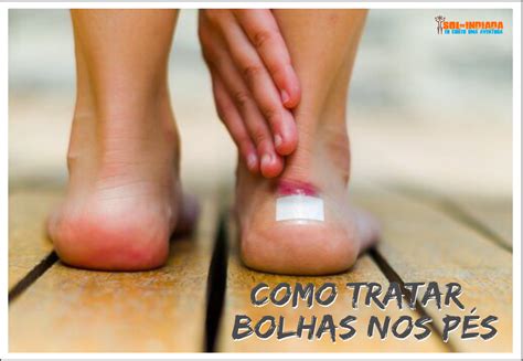 Bolhas No Pe O Que Pode Ser - COMO TRATAR AS BOLHAS NOS PÉS