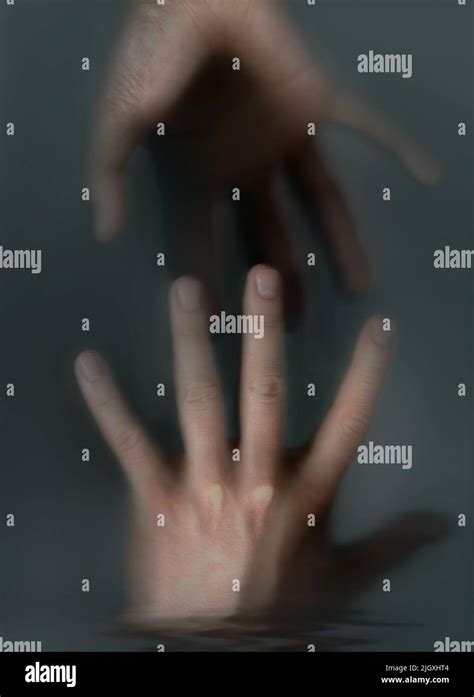 Burn scar hand hi-res stock photography and images - Alamy