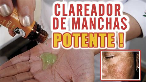 Como Clarear Manchas Na Pele