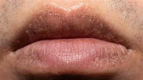 people commonly misidentify strange white bumps   find