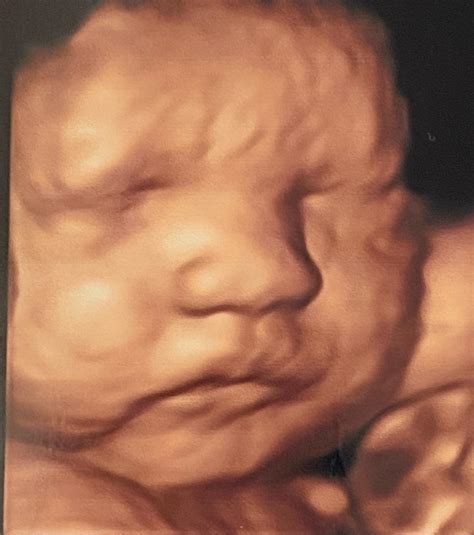 First Look Sonogram - Sneak peek tomorrow! Come in and find out by