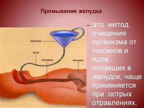 Промывание желудка - презентация онлайн